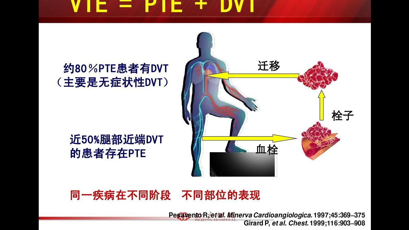 盘点那些为VTE代言的名人