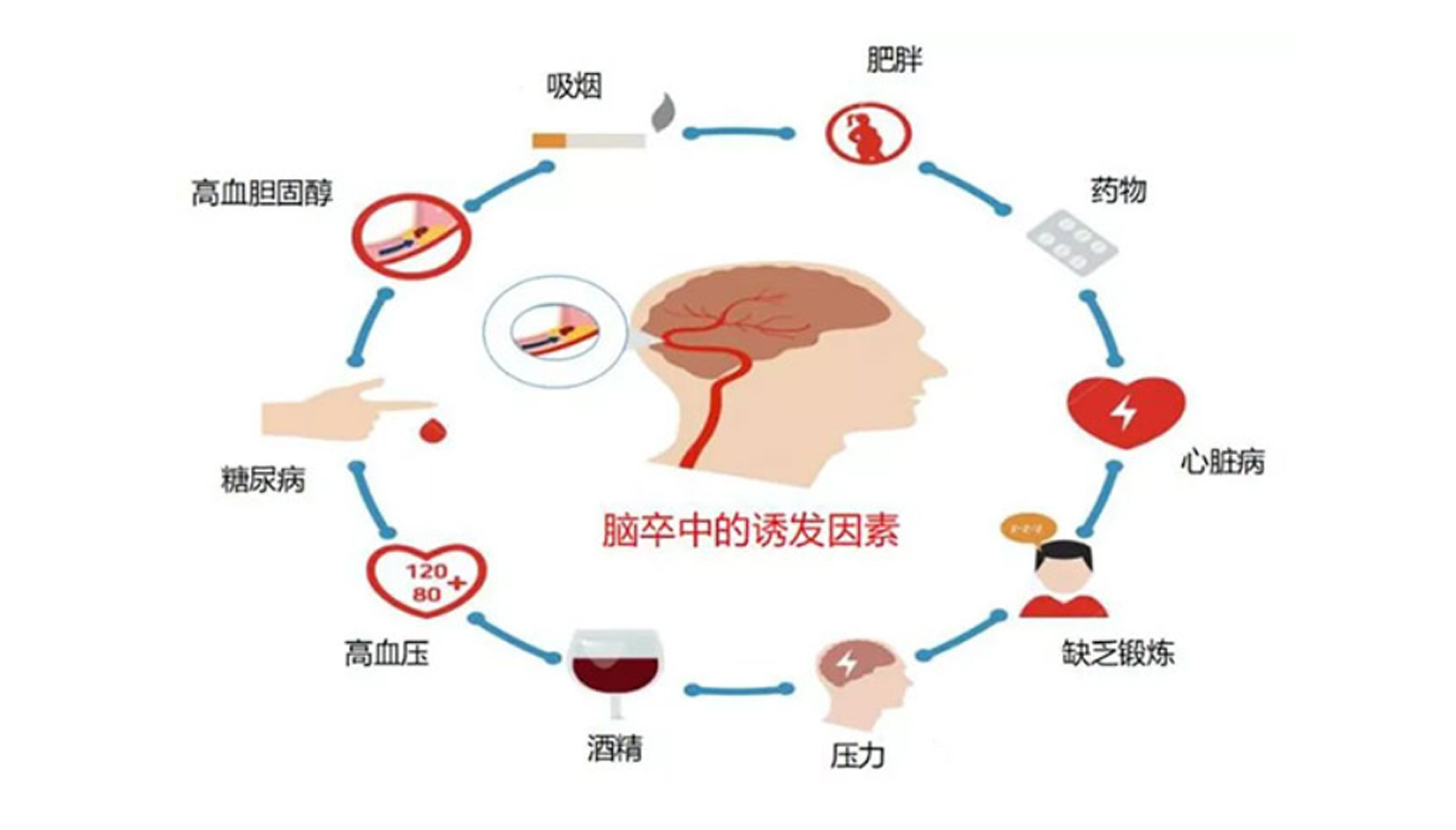 脑梗与深静脉血栓：不可忽视的血管危机