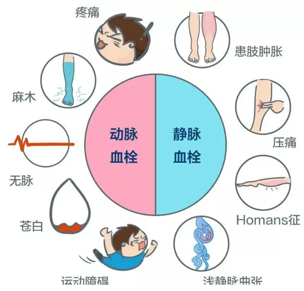 2022世界血栓日：就医有新路，血栓找介入