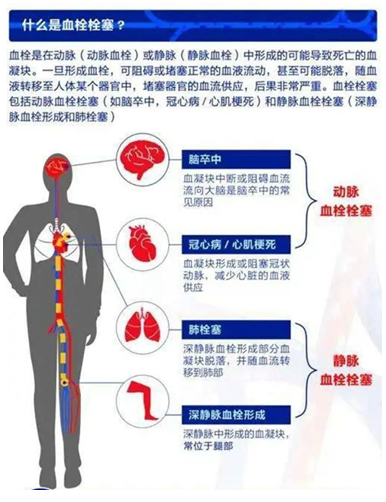 2022世界血栓日：就医有新路，血栓找介入