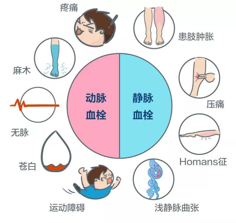 深静脉血栓能致命，防治“大法”要了解！