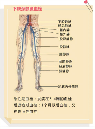 围生期静脉血栓栓塞症（VTE）